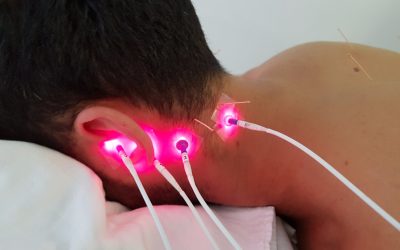 Acupunctuur als hulp bij het verhelpen van oorsuizingen